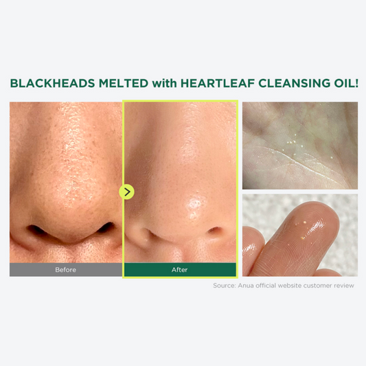 Korean | Cleansers Oil Oil Oil | Japanese Skin Cleansers – Cleansers Cupid