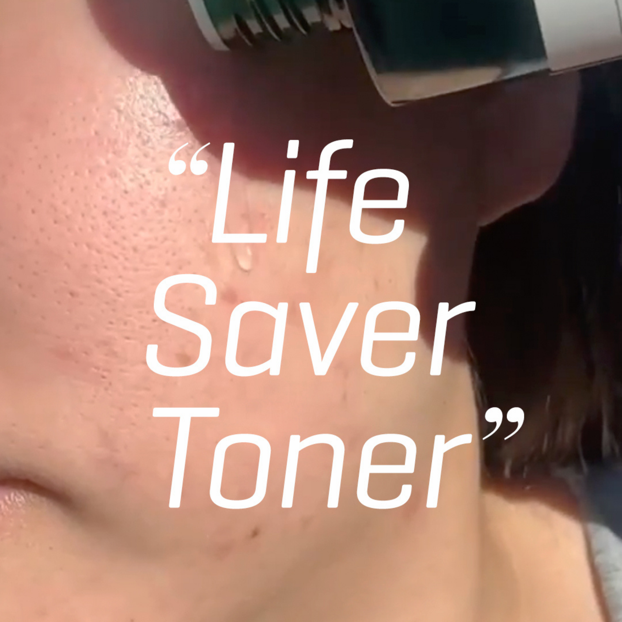 REVIEW] Some By Mi Aha/Bha/Pha 30 Days Miracle Toner (Before and